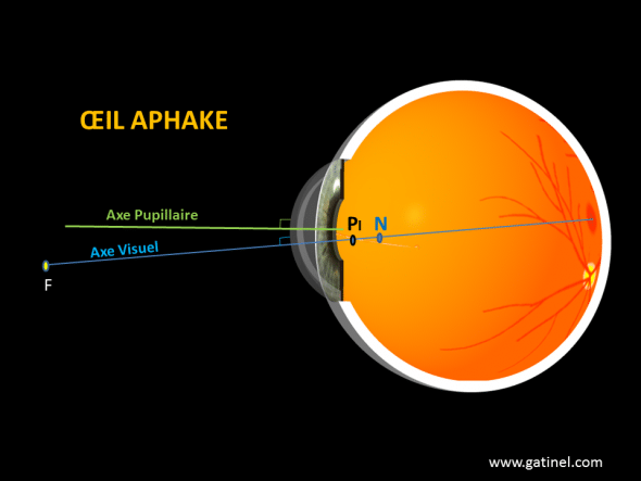 axe pupillaire axe visuel kappa aphake