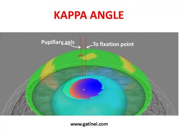 Axa pupilară și unghiul kappa reprezentate într-o imagine 3D