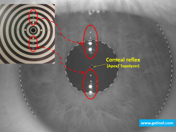 The location of the corneal reflex is performed with regards to the limbus.
