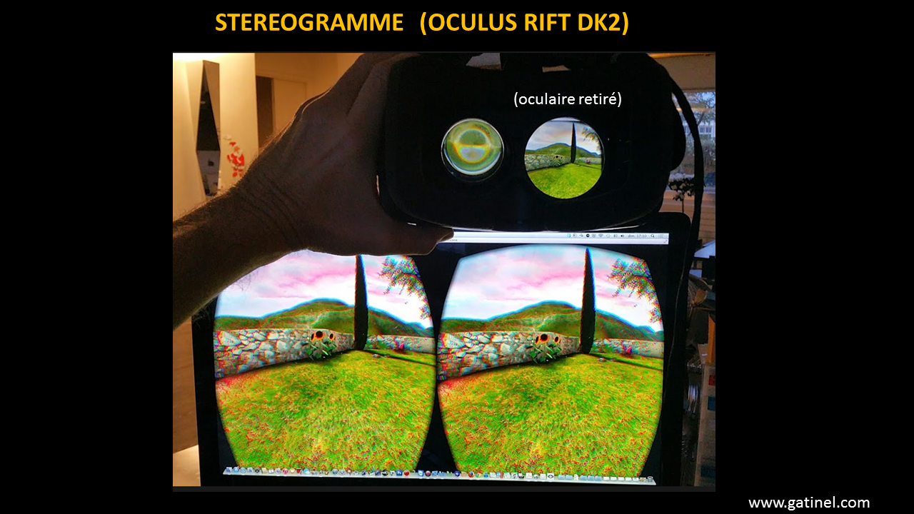 Casque de réalité virtuelle - Docteur Damien Gatinel