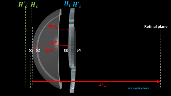 effective lens position vs anterior lens position vs internal lens position in IOL power formula